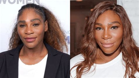 serena williams plastic surgery|Serena Williams Plastic Surgery.